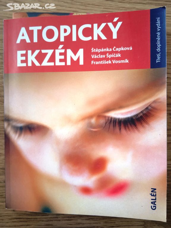 Atopický ekzém